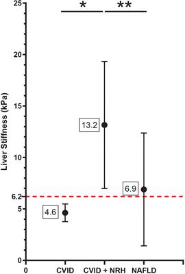 Liver Stiffness by Transient Elastography Correlates With  Degree of Portal Hypertension in Common Variable Immunodeficiency Patients With Nodular Regenerative Hyperplasia